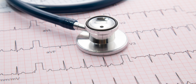 Stetoscopio su tracciato elletrocardiografico, immagine dedicata al servizio ECG in Farmacia per adulti e bambini prima della ripresa dell'attività sportiva